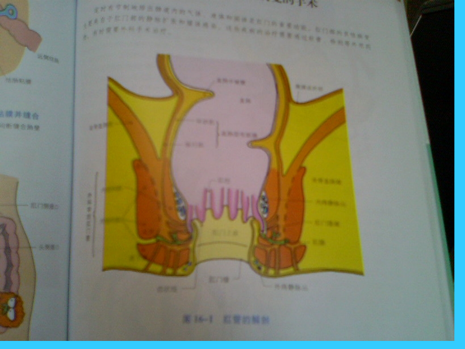 [最新]罕见肛周疾病的诊断 o(╯□╰)o_第3页