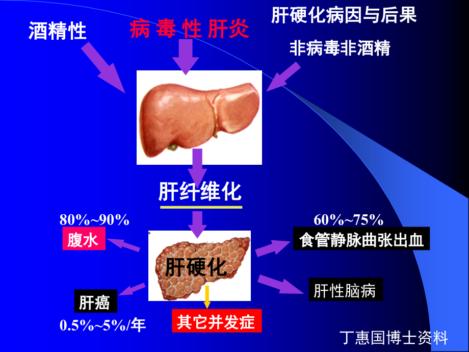 10.肝硬化的诊断与治疗(11.2 mb)［ppt课件］_第4页