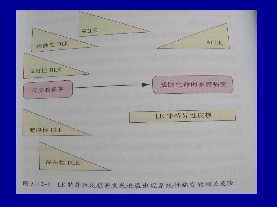 SLE的皮肤表现ppt课件_第4页