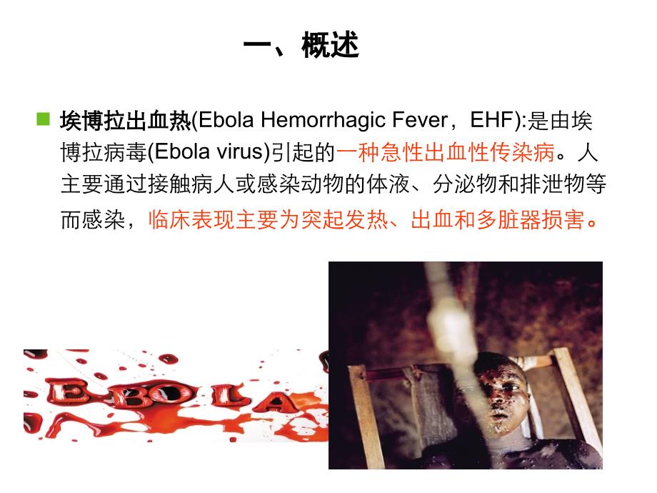 埃博拉疫情及秋冬常见传染病的防护PPT课件_第4页