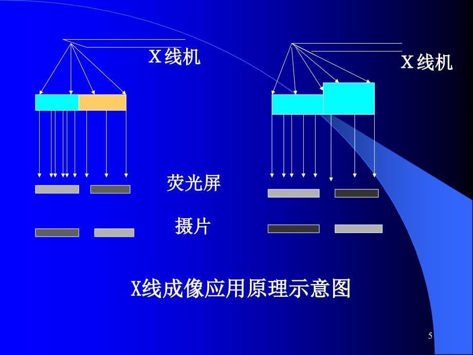 X线检查ppt课件_第5页