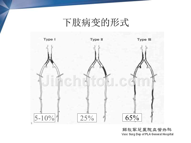 下肢动脉硬化闭塞性病变10个应当注意的问题2011最新课件_第3页