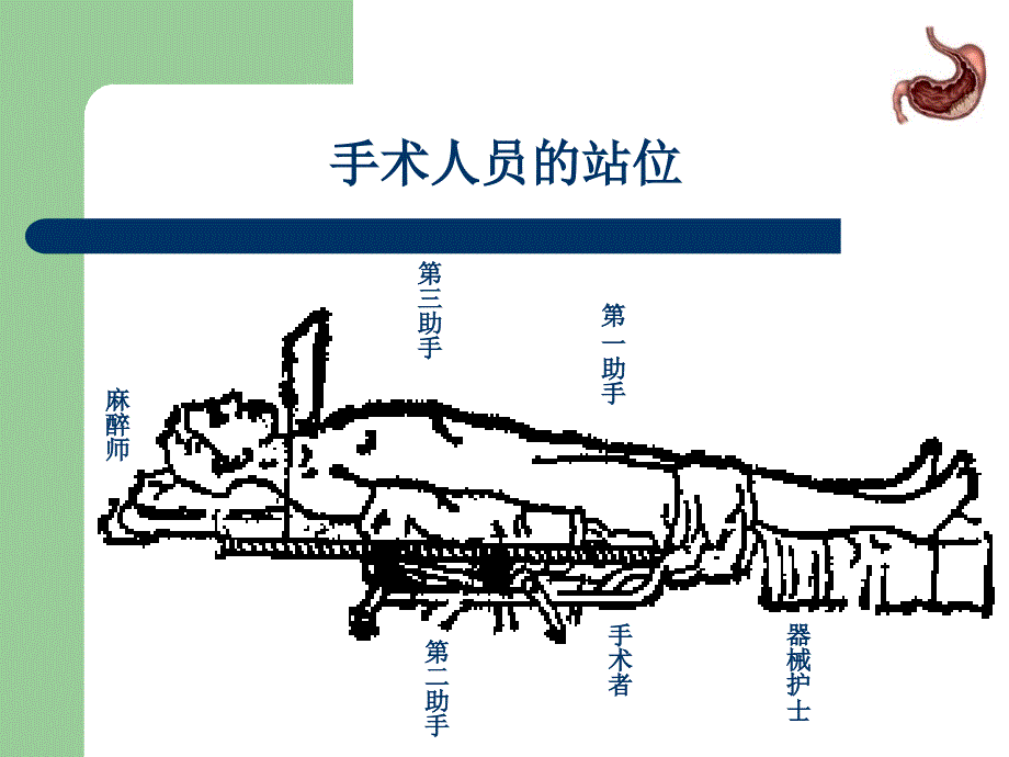 最新远端胃癌根治(d2)手术规范_第4页