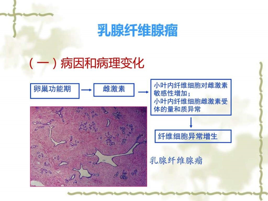 常见乳腺肿瘤的影像表现_图文.ppt_第3页