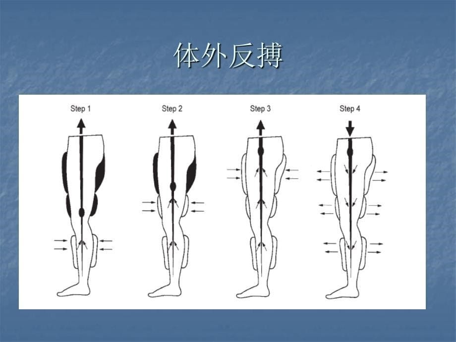 主动脉内气囊反搏（）ppt课件_第5页