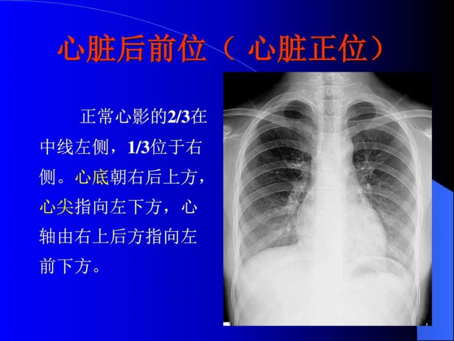 正常心脏大血管的放射学表现_图文.ppt_第2页