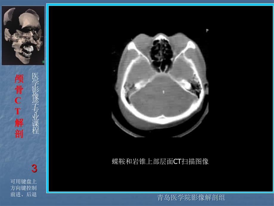 头颈部ctppt课件_第3页