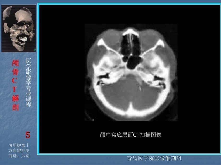 头颈部ctppt课件_第5页