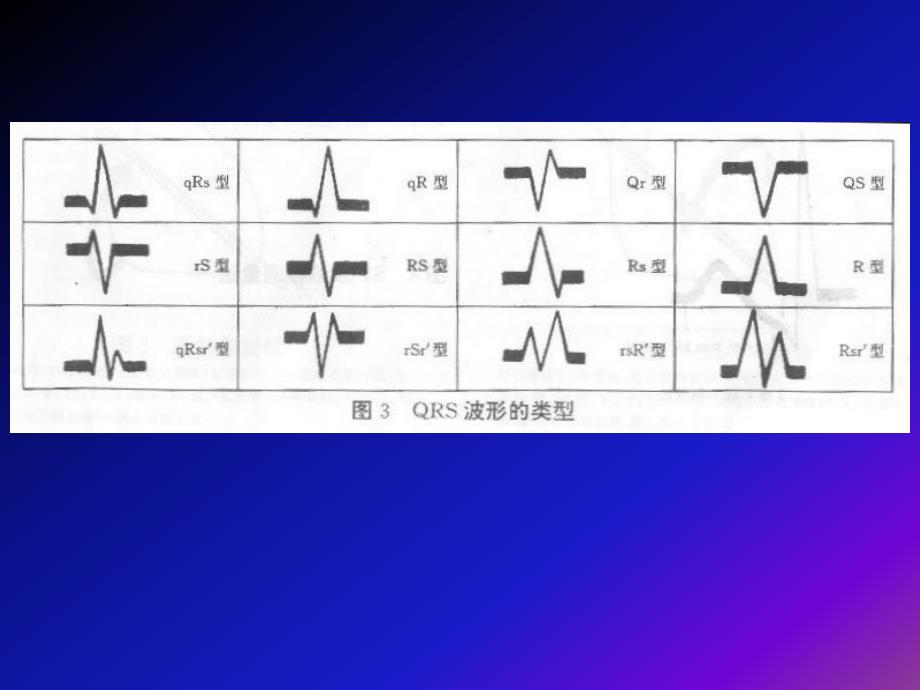 心电图的基本知识31787 ppt课件_第4页