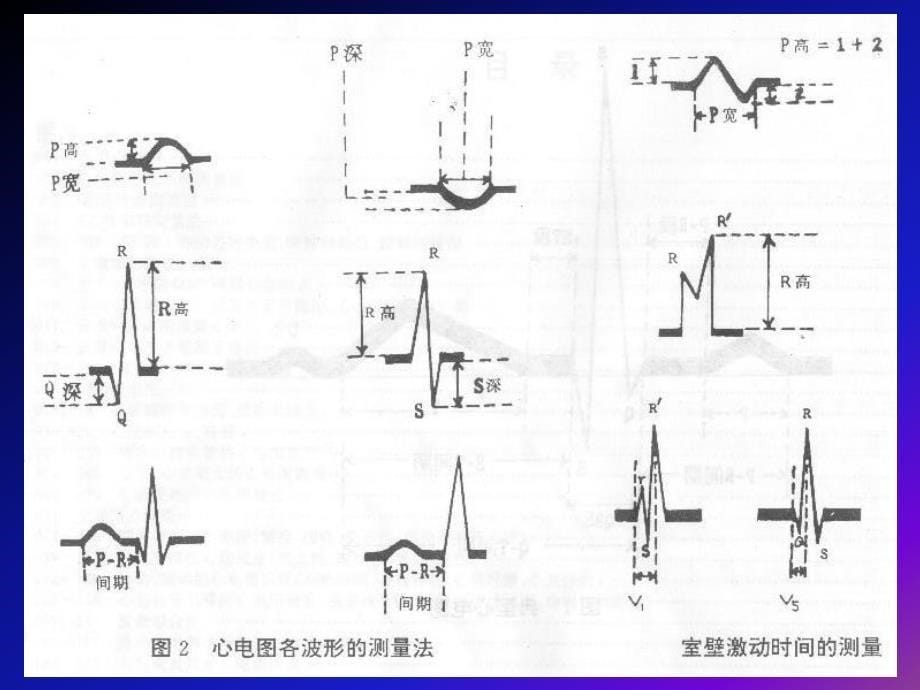 心电图的基本知识31787 ppt课件_第5页