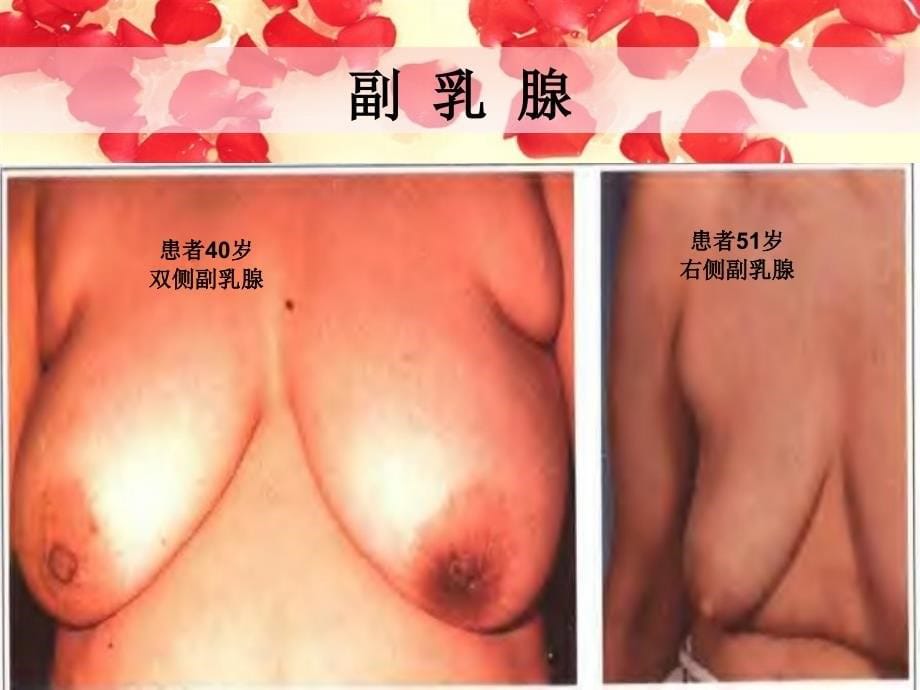 女性：关爱乳房健康_第5页