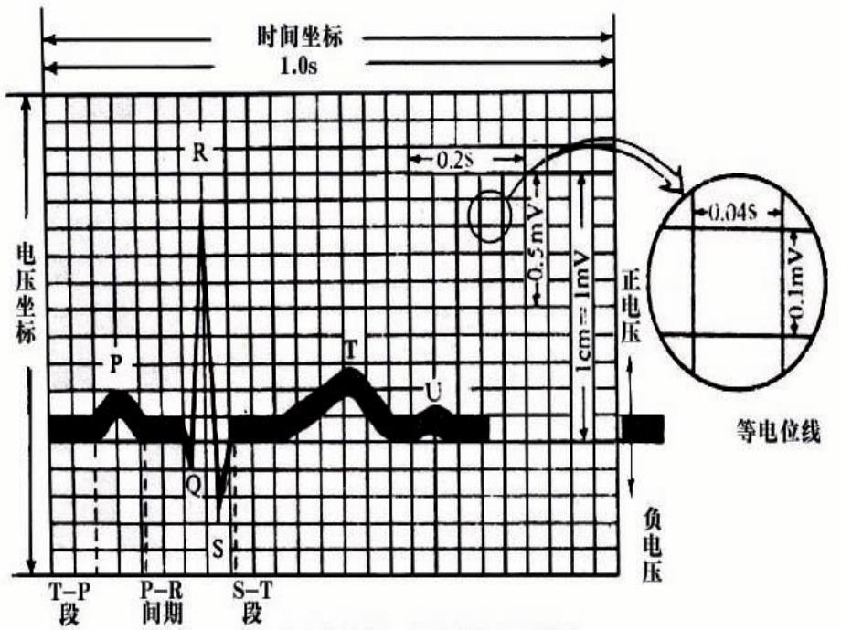 怎样看正常心电图ppt课件_第3页