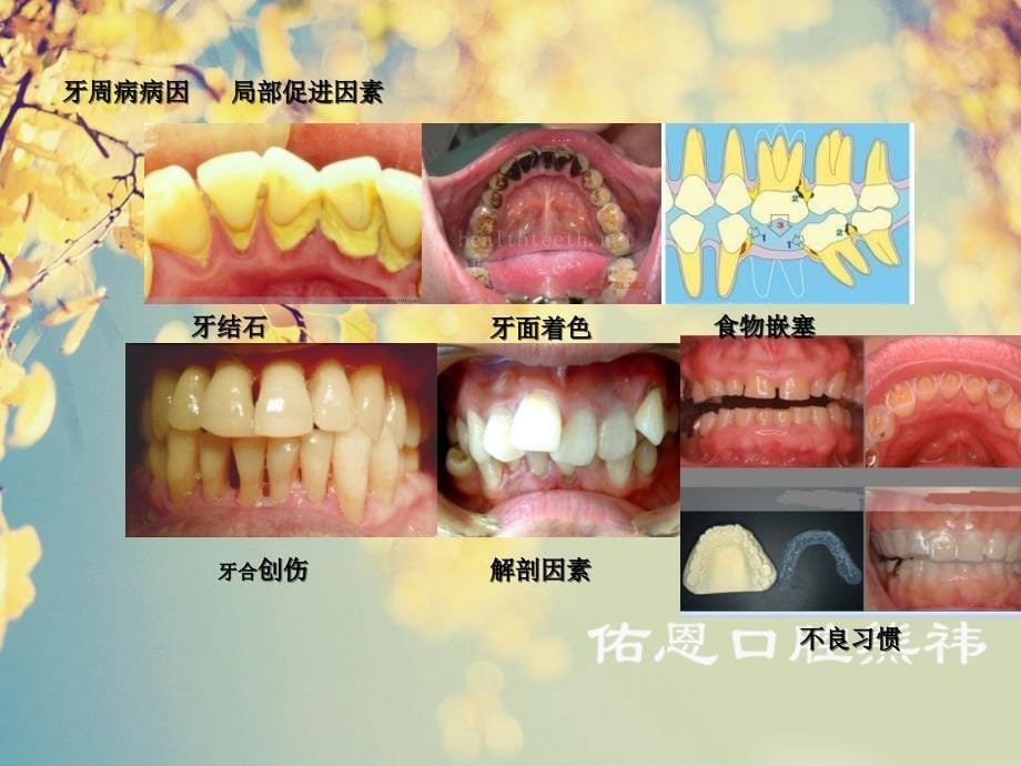 口腔知识讲座第三课ppt课件_第5页