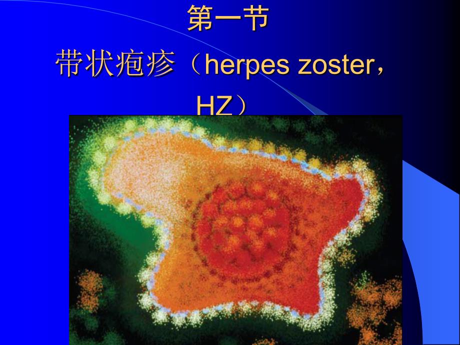 带状疱疹的诊断治疗进展ppt,下载!_第2页