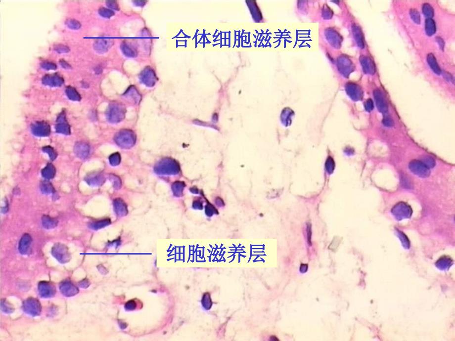 妊娠期子宫内膜ppt课件_第4页