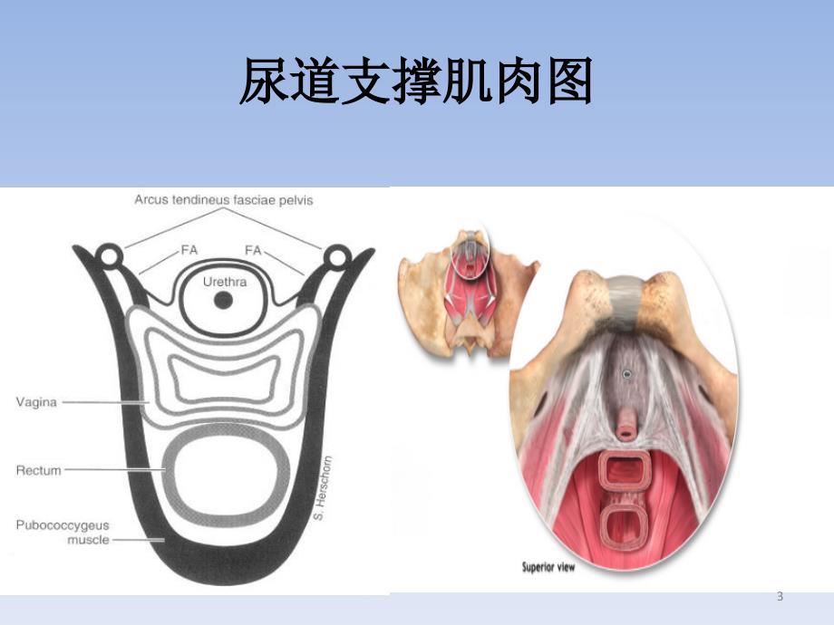 手术方式选择的思考_第3页