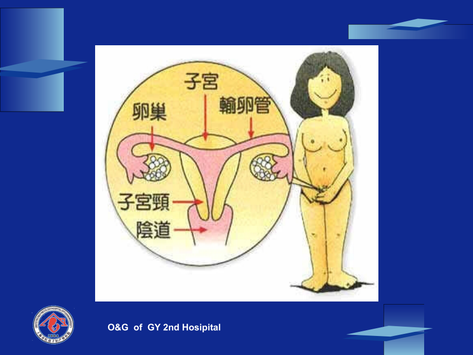 妇科肿瘤.ppt_第3页