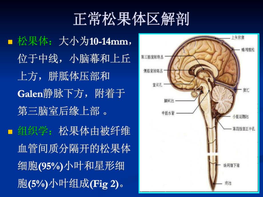 松果体细胞瘤ppt课件_第2页