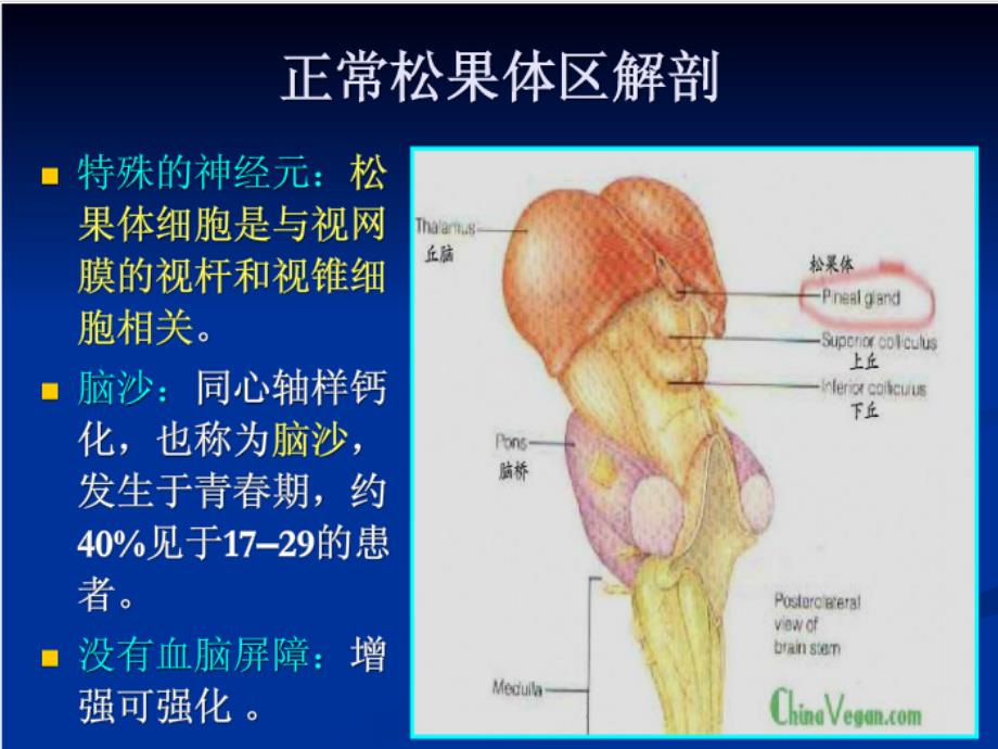 松果体细胞瘤ppt课件_第3页