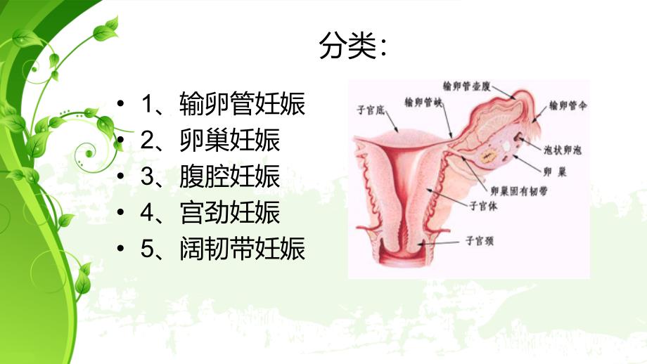 异位妊娠(课件)84262_第3页