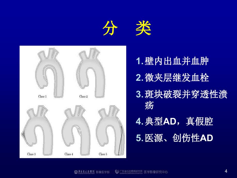 在主动脉夹层诊断中的应用_第4页