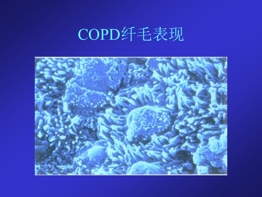 哮喘copd的诊治新进展.ppt_第3页