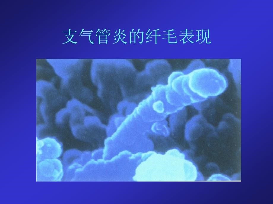 哮喘copd的诊治新进展.ppt_第5页