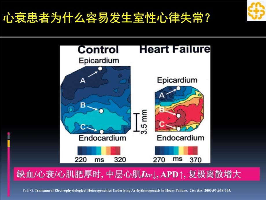 心衰合并室性心律失常_ppt课件_第4页