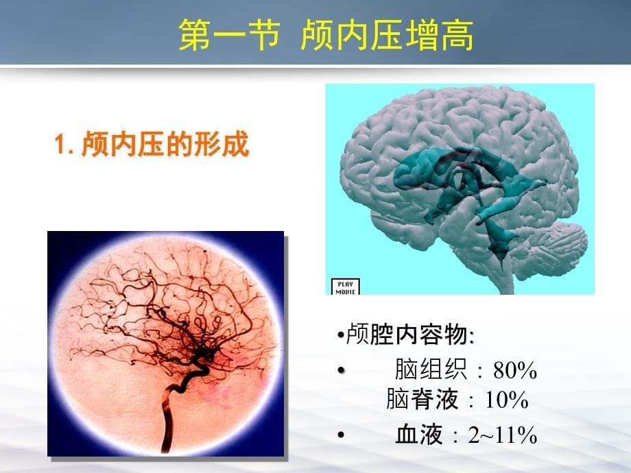 颅内压增高-河南护理学院-河南护理职业学院_第5页