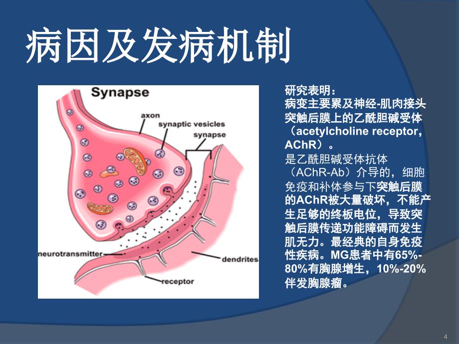 MG的护理 ppt课件_第4页