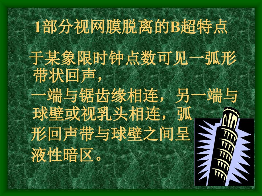 眼部b超的诊断与鉴别诊断课件_第4页