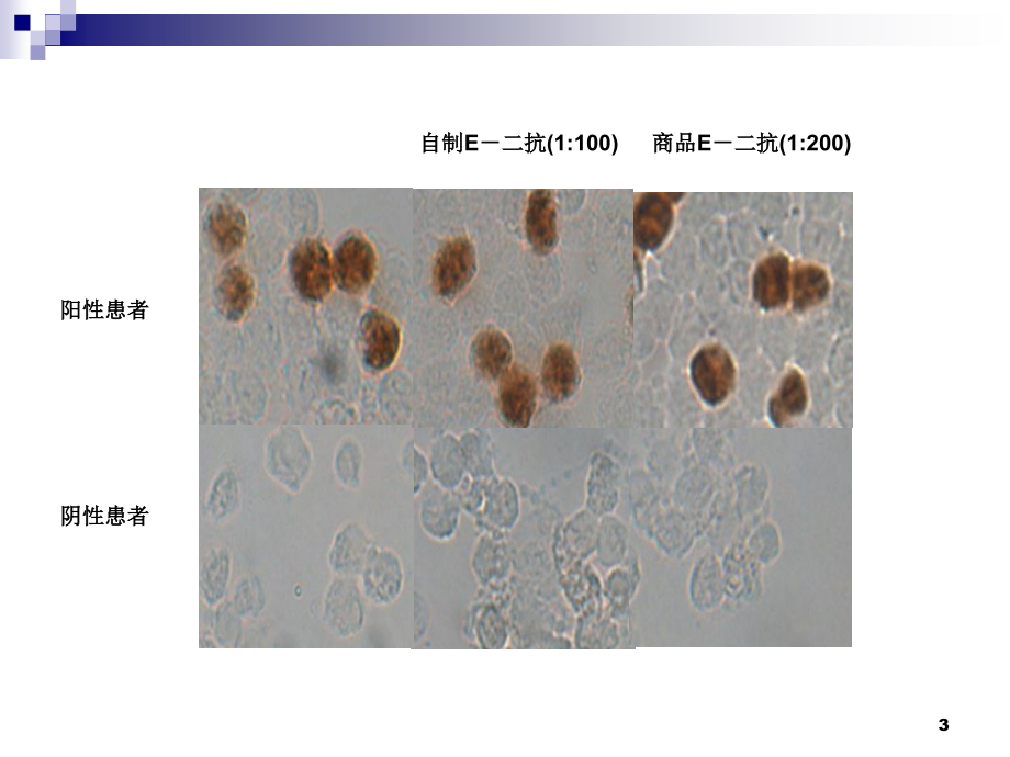 人巨细胞病毒潜伏激活感染诊断的进展课件_第3页