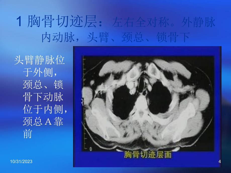 胸部ct读片课件_第4页