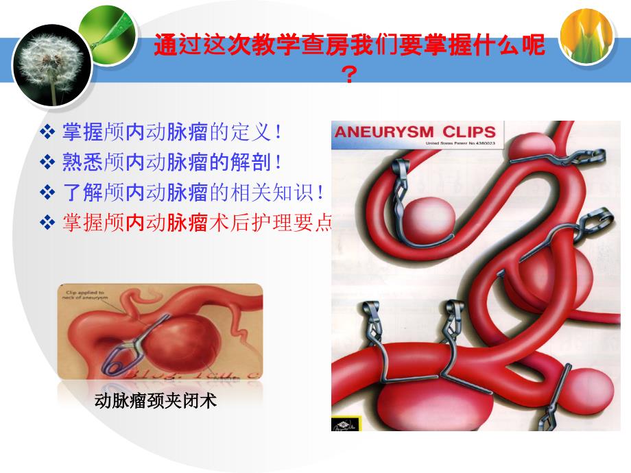 动脉瘤夹闭术护理教学查房课件_第2页