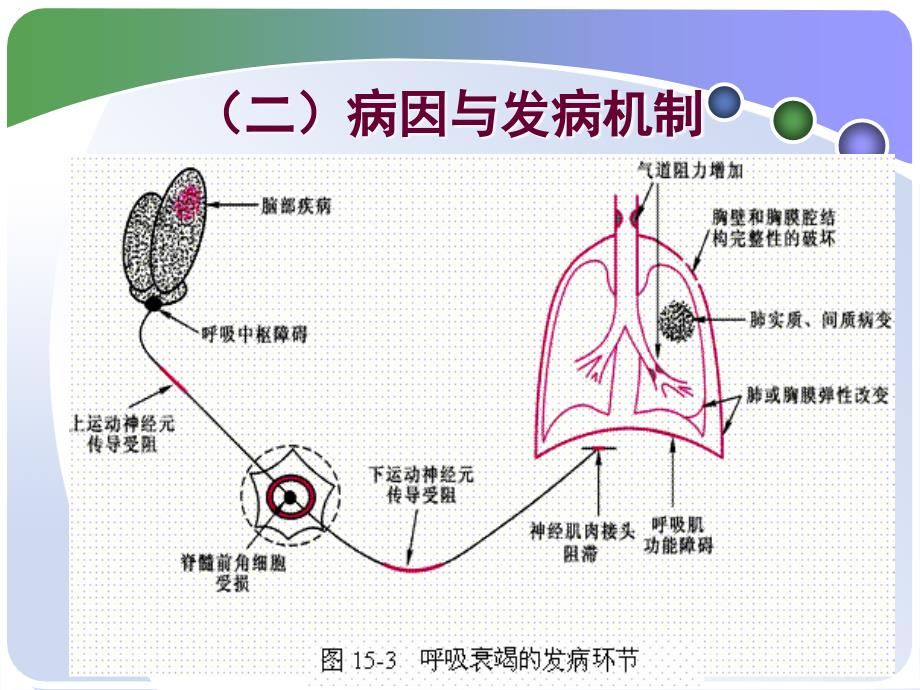 内科护理学_（第五版）第二章第15节呼吸衰竭和急性呼吸窘迫综合征课件_第4页