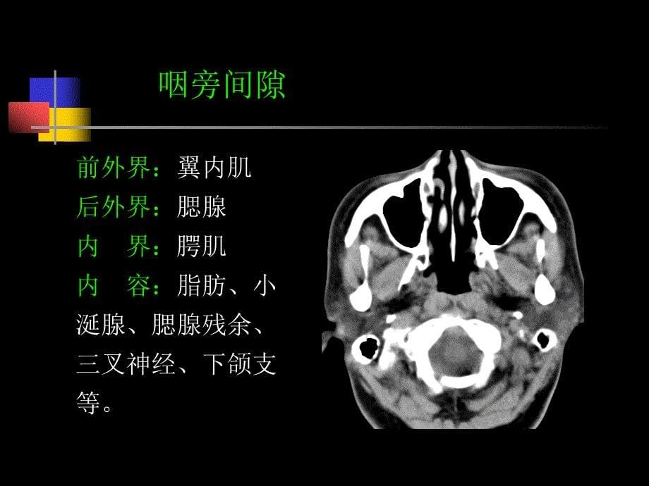 鼻咽部的CT解剖ppt课件_第5页