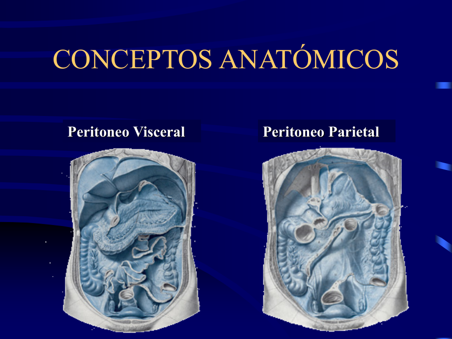 _intraabdominales  mastersoft腹腔感染玛斯特课件_第2页