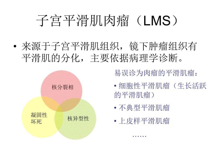 子宫肉瘤的诊断和课件_第5页