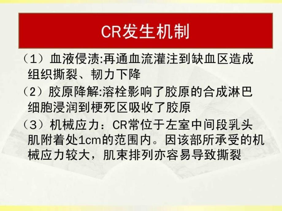 急性心肌梗死后心脏破裂早期临床识别与防治课件_第4页