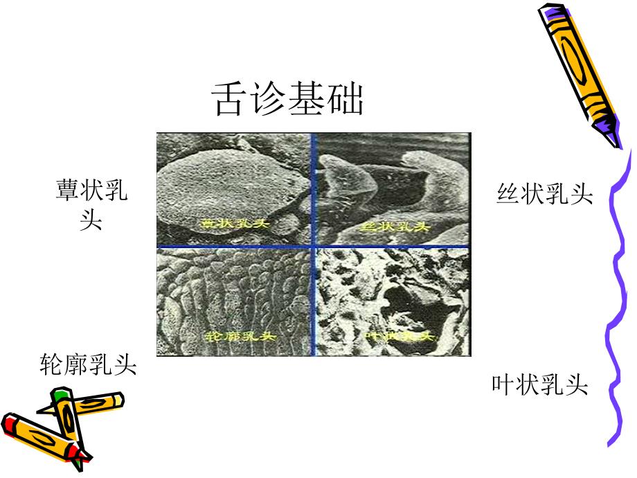 中医望诊舌诊课件_第4页