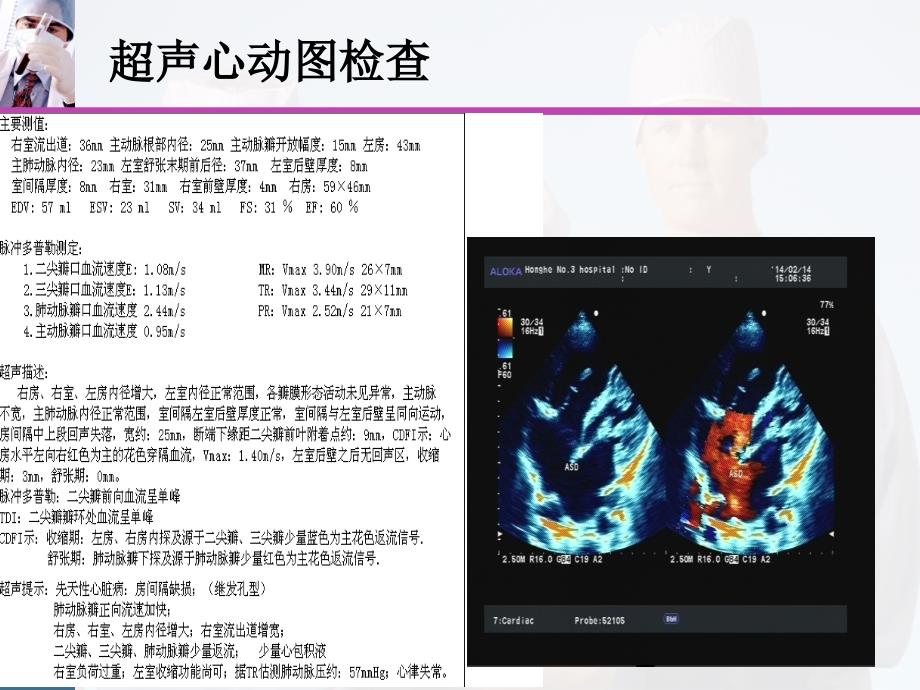 房缺修补术后大量心包积液一例课件_第4页