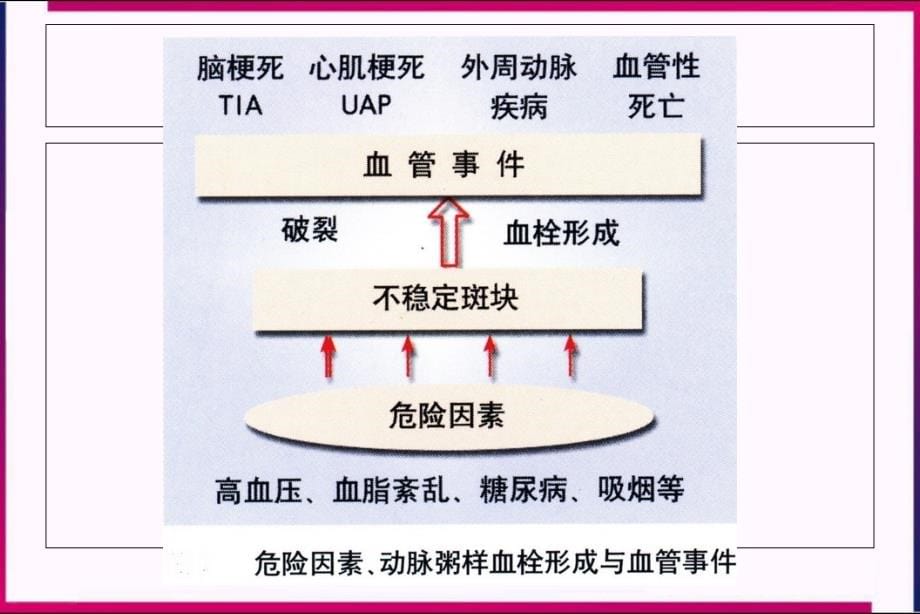 心血管易损病人课件_第5页