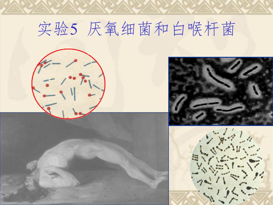 实验五_厌氧菌和白喉菌课件_第2页