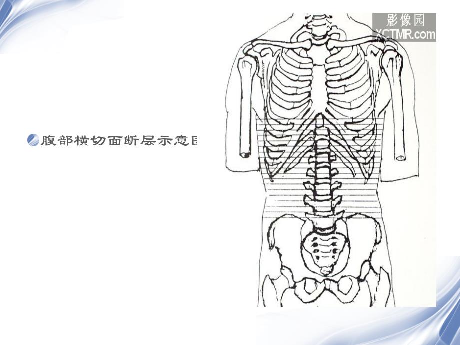 人体断层解剖图谱腹腔_ppt课件_第2页