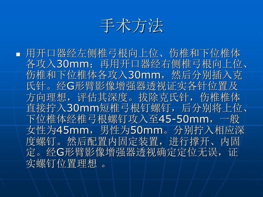 后路伤椎置短椎弓根螺钉技术治疗胸腰椎骨折课件_第5页