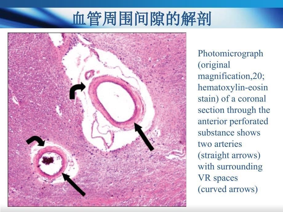 血管周围间隙_1课件_第5页