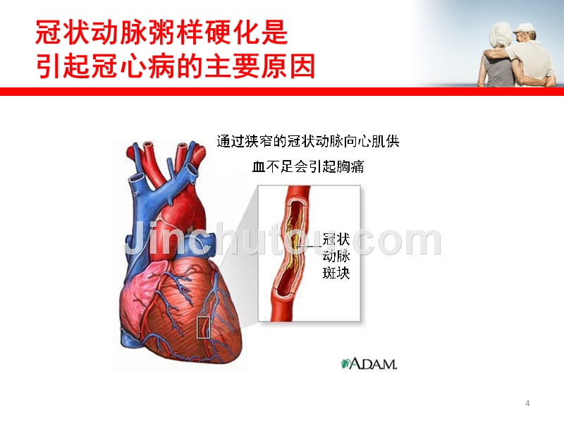 精华操纵血脂与防备心脑血管疾病课件_第4页