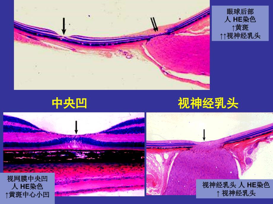 脉络膜和视网膜中央凹视神经乳头视网膜中央凹人he染色黄斑中心_课件_第4页