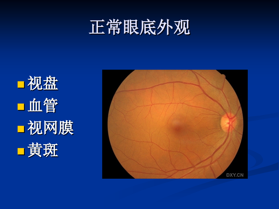 视网膜病图谱课件_第4页