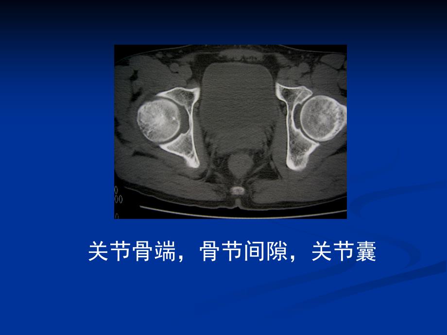 课件第一节 检查技术  第二节   影像观察与分析_第3页